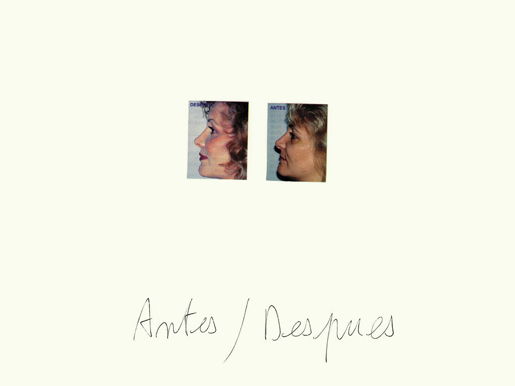Claude Closky, ‘Antes /  Despues (mujer) [Before / After (woman)]’, 1997, black ballpoint pen and collage on paper, 32 x 24 cm.
