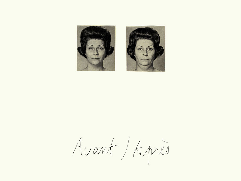 Claude Closky, ‘Avant / Après (double-menton) [Before / After (double chin)]’, 1997, black ballpoint pen and collage on paper, 32 x 24 cm.