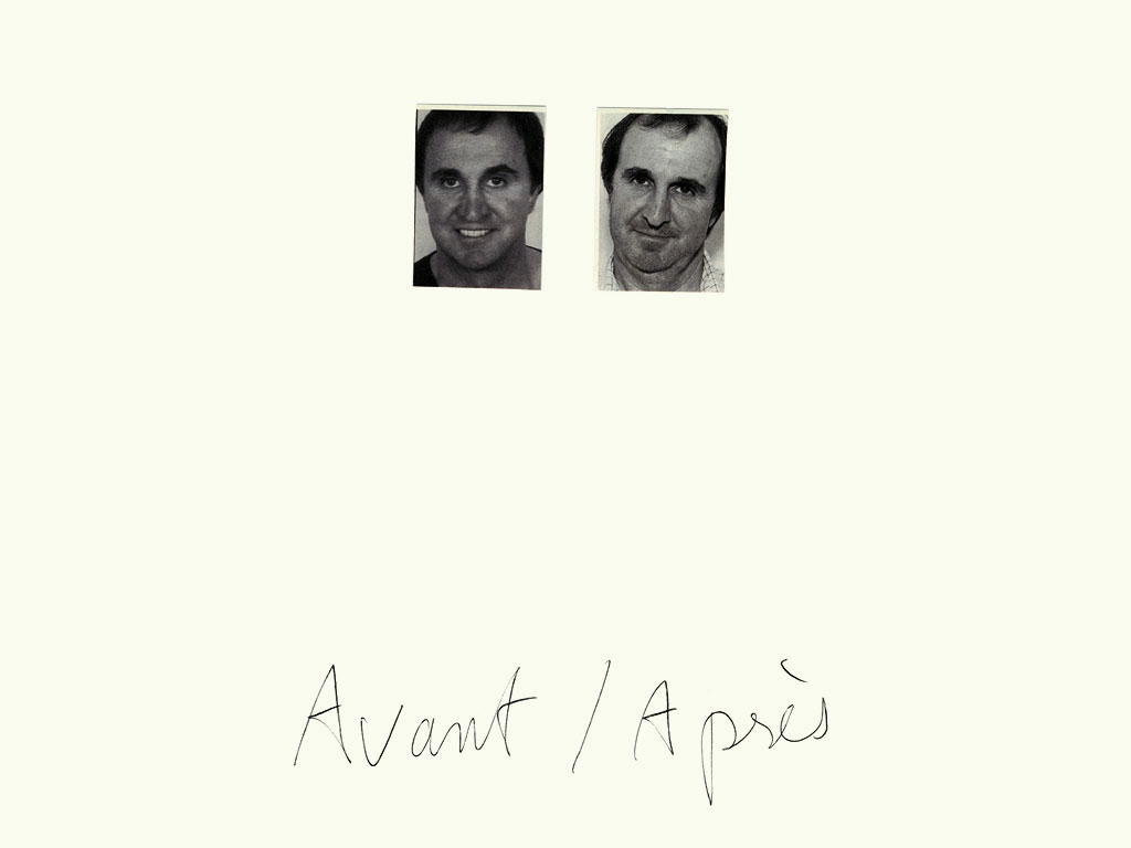 Claude Closky, ‘Avant / Après (visage homme) [Before / After (man’s face)]’, 1997, black ballpoint pen and collage on paper, 32 x 24 cm.