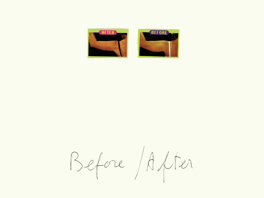 Claude Closky, ‘Before / After (arm) ’, 1997, black ballpoint pen and collage on paper, 32 x 24 cm.