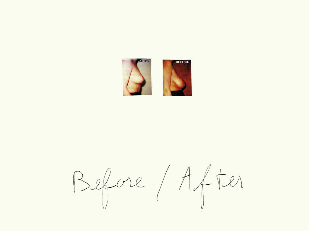 Claude Closky, ‘Before / After (breast)’, 1997, black ballpoint pen and collage on paper, 32 x 24 cm.