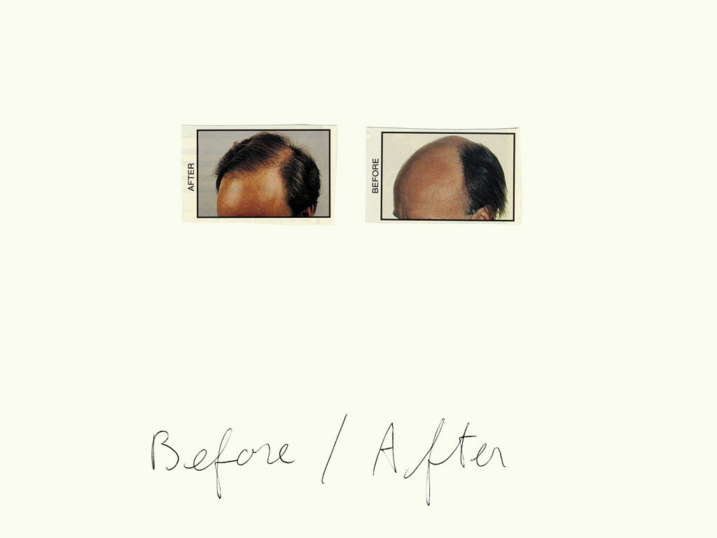 Claude Closky, ‘Before / After (dark hair)’, 1997, black ballpoint pen and collage on paper, 32 x 24 cm.
