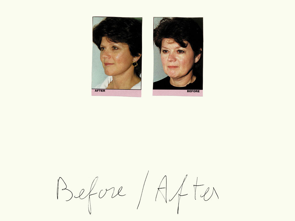 Claude Closky, ‘Before / After (woman)’, 1997, black ballpoint pen and collage on paper, 32 x 24 cm.